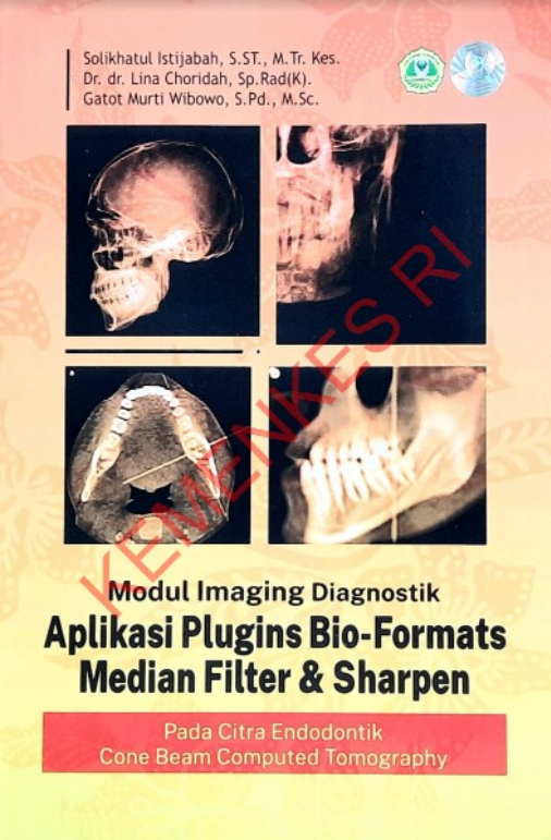 Modul Imaging Diagnostik Aplikasi Plugins Bio-Formats Median Filter &amp;amp; Sharpen