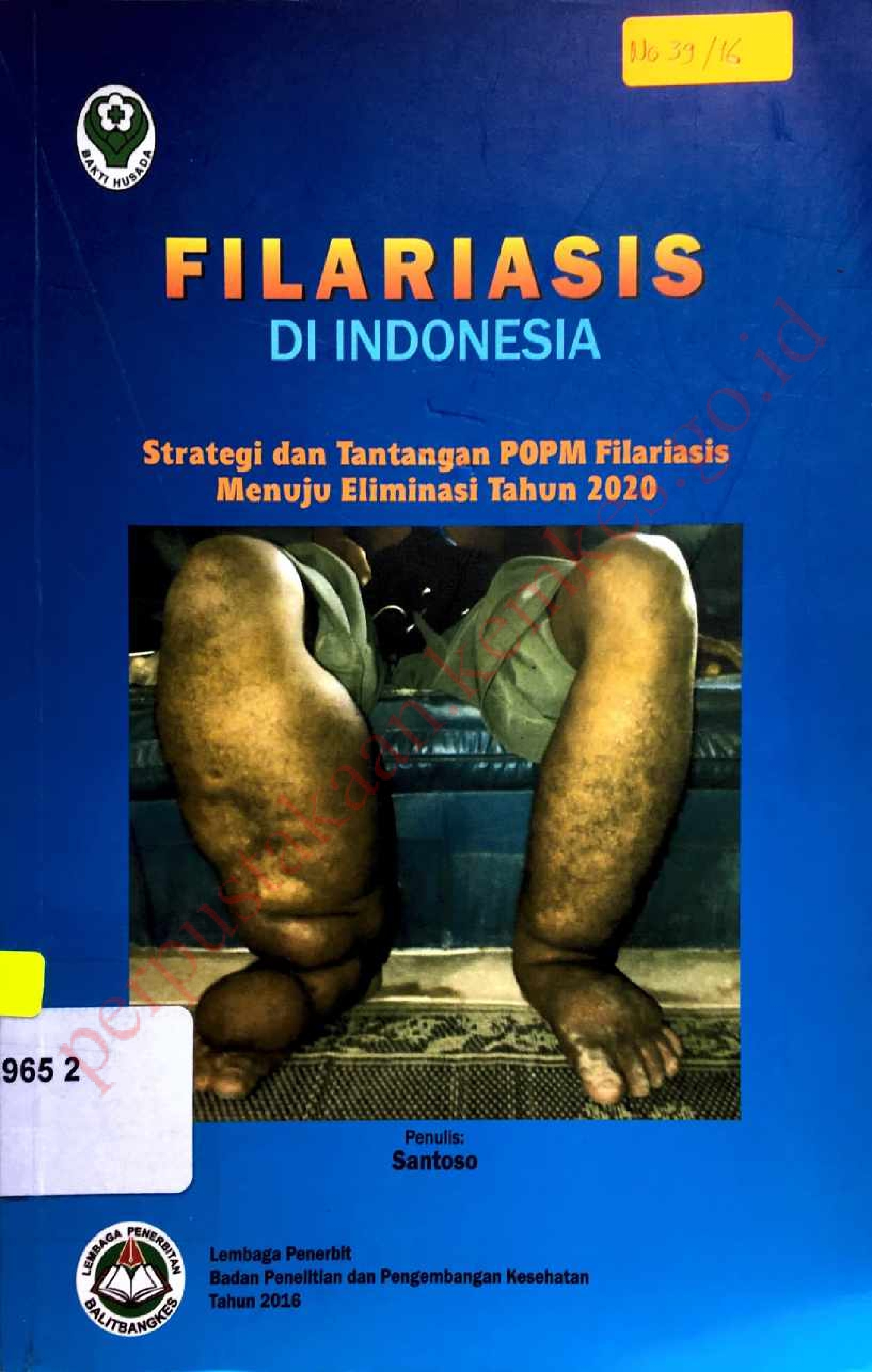 Filariasis di Indonesia : Strategi dan Tantangan POPM Filariasis Menuju Eliminasi Tahun 2020